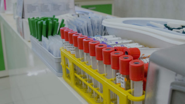 Эффективны ли российские тесты на коронавирус и почему меры правительства вызывают так много вопросов