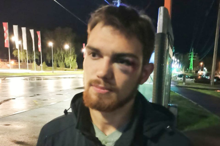 Активист «Гражданского общества» Глеб Марьясов после нападения