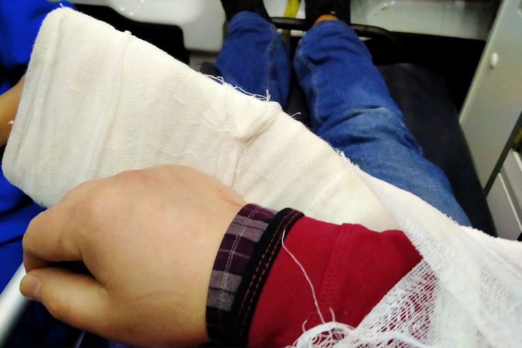 Сломанная рука журналиста Сергея Колотовкина