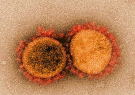 Микрофотография вирусных частиц SARS-CoV-2