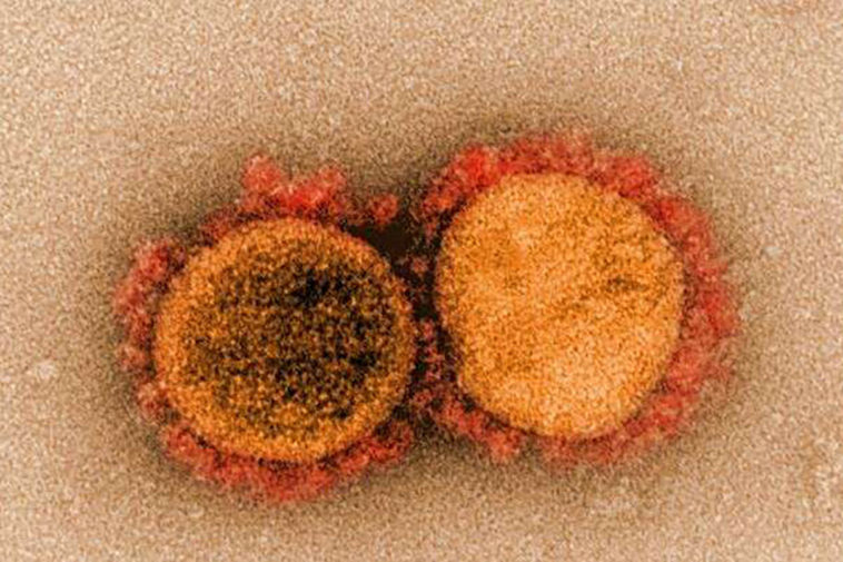 Микрофотография вирусных частиц SARS-CoV-2